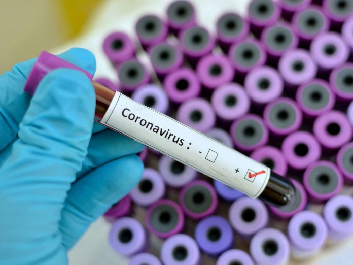 coronavirus, covid-19, serological survey oman